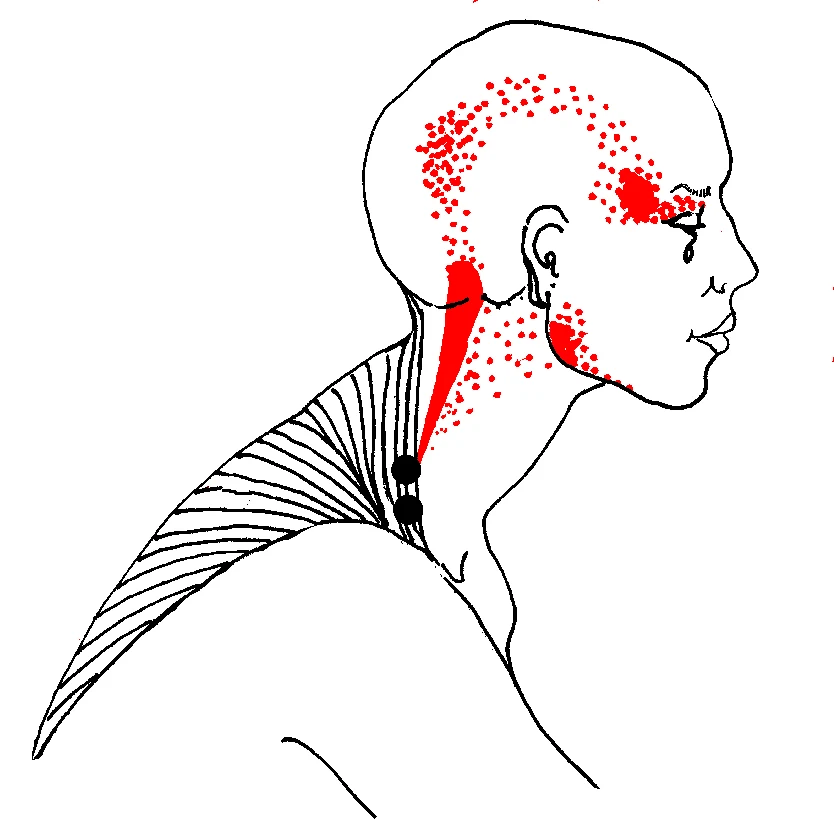 Neck pain & headaches