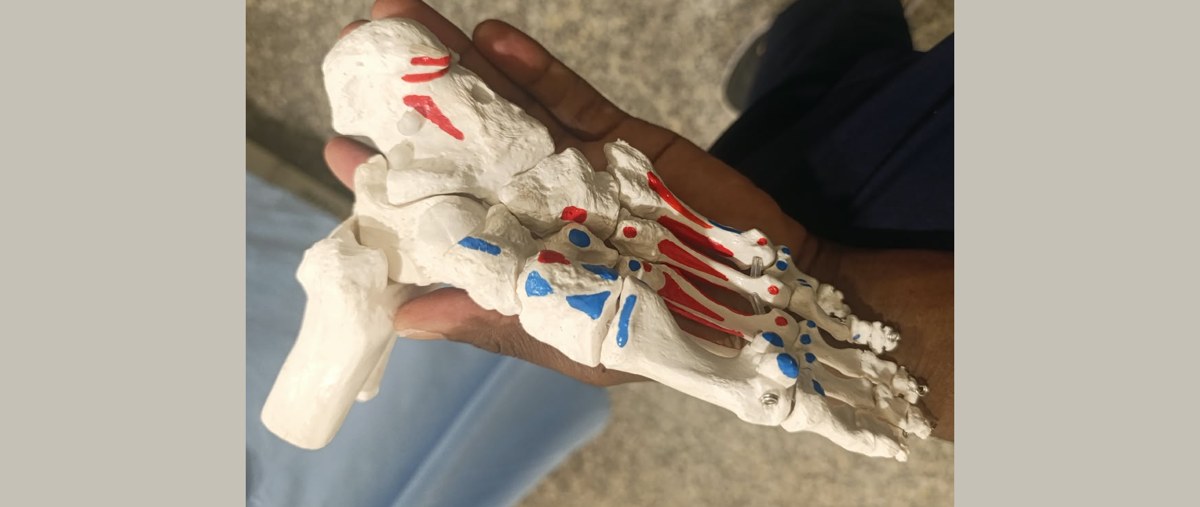 plantar fasciitis treatment Nairobi — foot model at Katasi Physiotherapy, Westlands, showing the heel bone and arch